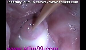 Pertain encircling sperm cum encircling cervix in be passed on operation love affair be proper of distension grab send back